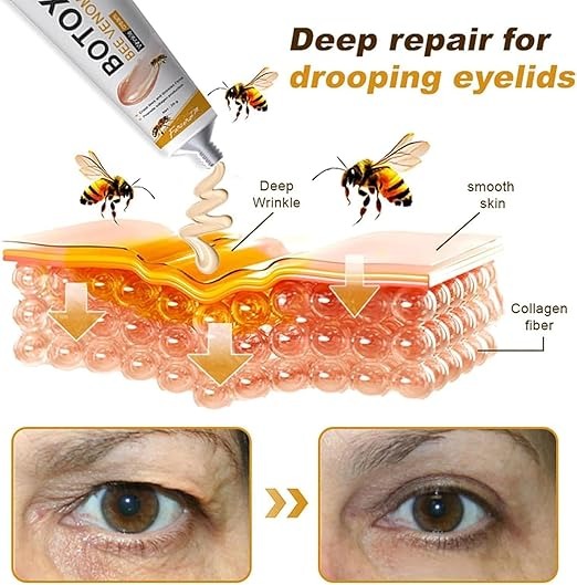 Wrinkle Removal Cream